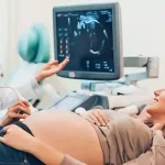 Key Benefits of Precast Concrete in Modern Construction